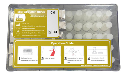 Urine Microalbumin Test